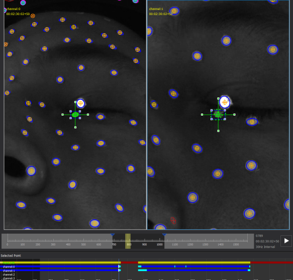 Occlusion2_sm.png